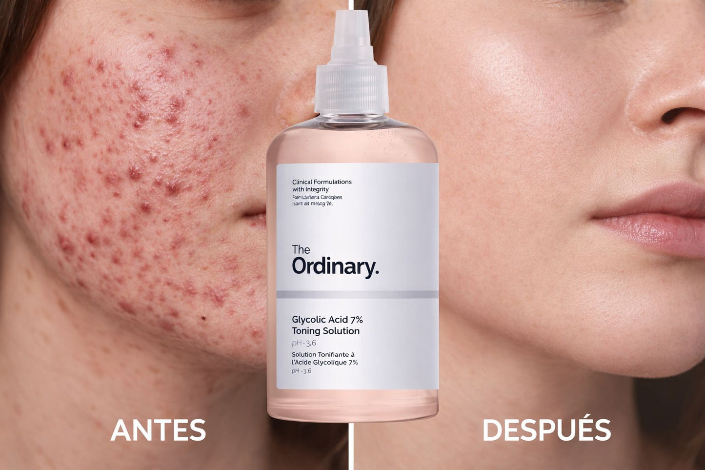 ACIDO GLICOLICO THE ORDINARY